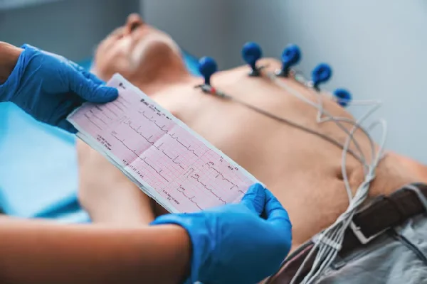 ECG